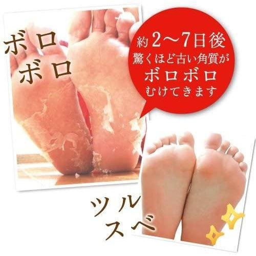 リベルタ ベビーフット 角質除去フットピール 30分トリートメント - サイズS